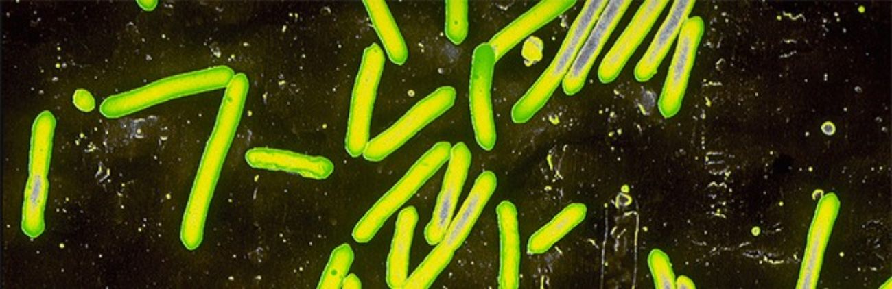Clostridium tetani Bakterien